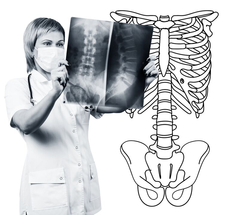 Lendenwirbelsäulenradiographie